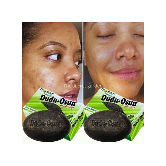 Dudu Osun Black Soap – Fresh Fragrance