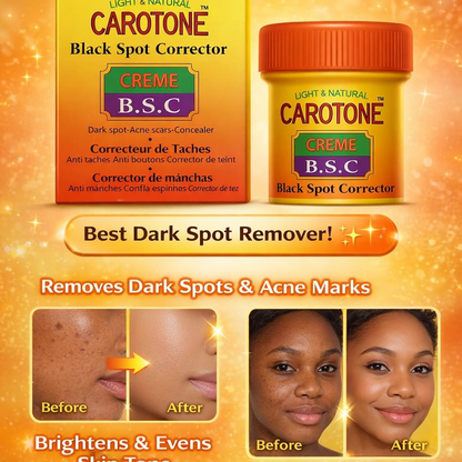 Carotone 30ml Skin Care Cream