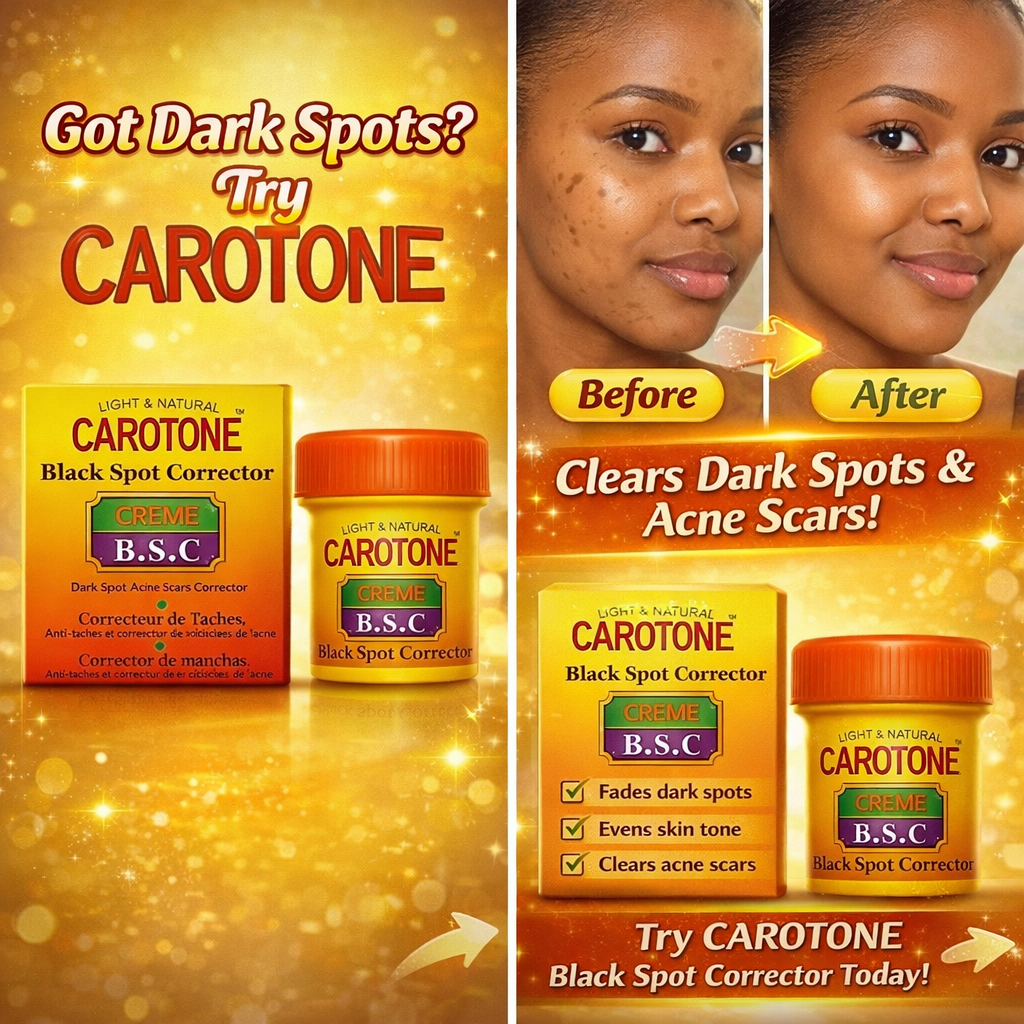 Carotone 30ml Skin Care Cream