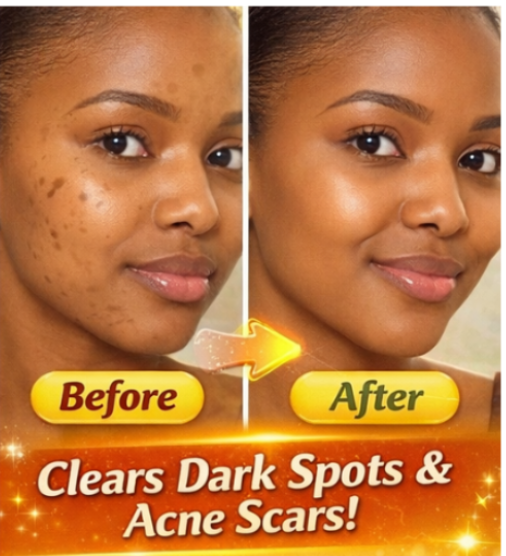 Carotone Dark Spot Corrector 30ml