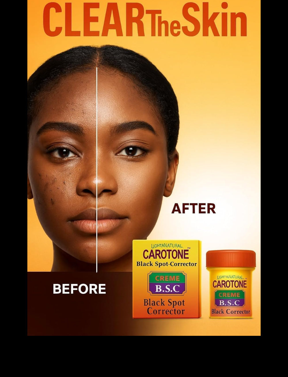 Carotone Dark Spot Corrector 30ml